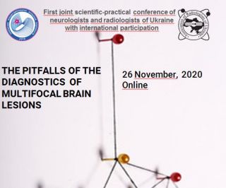 The pitfalls of the diagnostics  of multifocal brain lesions