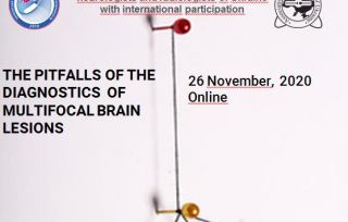 The pitfalls of the diagnostics  of multifocal brain lesions